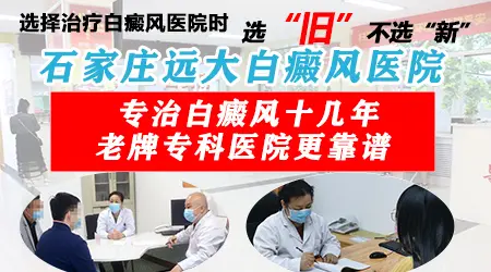 进展期白癜风能用卡力孜然酊吗