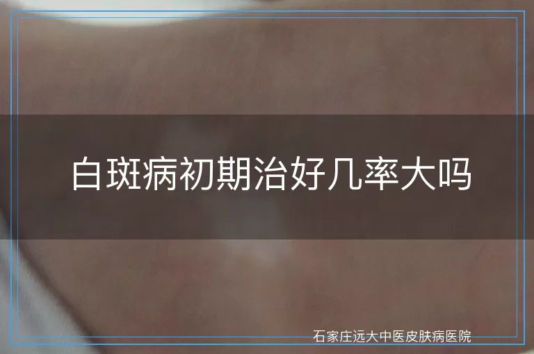 白斑病初期治好几率大吗