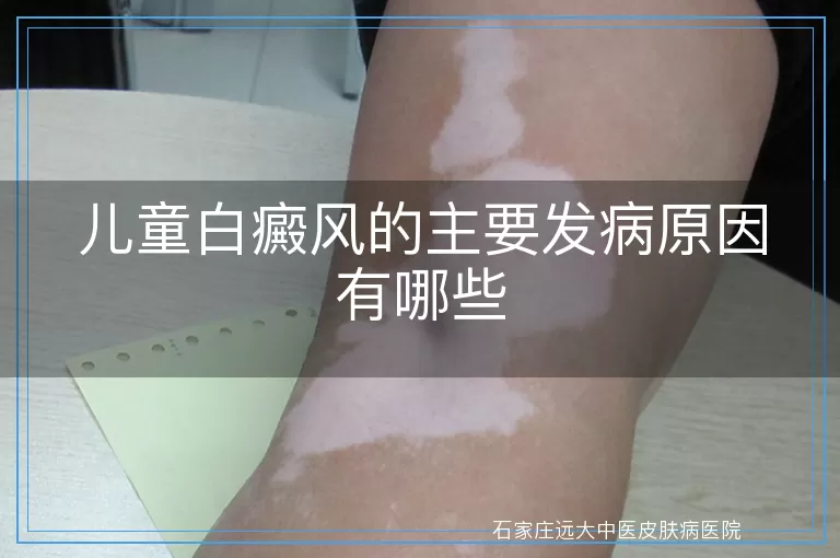儿童白癜风的主要发病原因有哪些