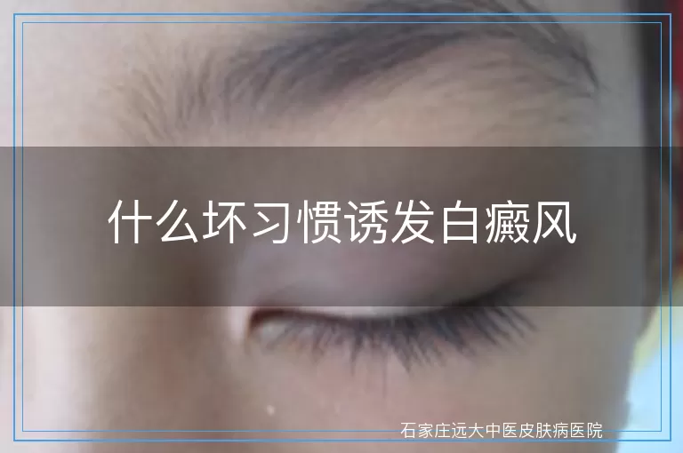 什么坏习惯诱发白癜风