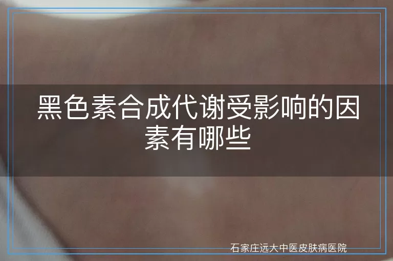 黑色素合成代谢受影响的因素有哪些