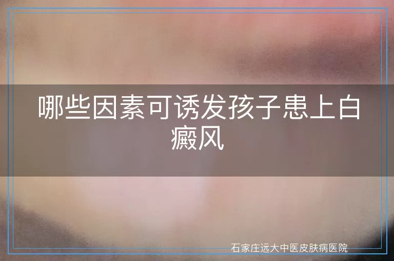 哪些因素可诱发孩子患上白癜风