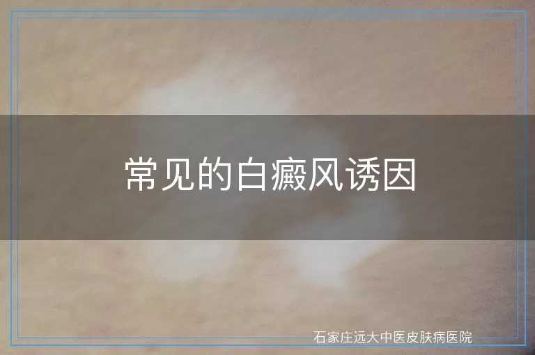 常见的白癜风诱因