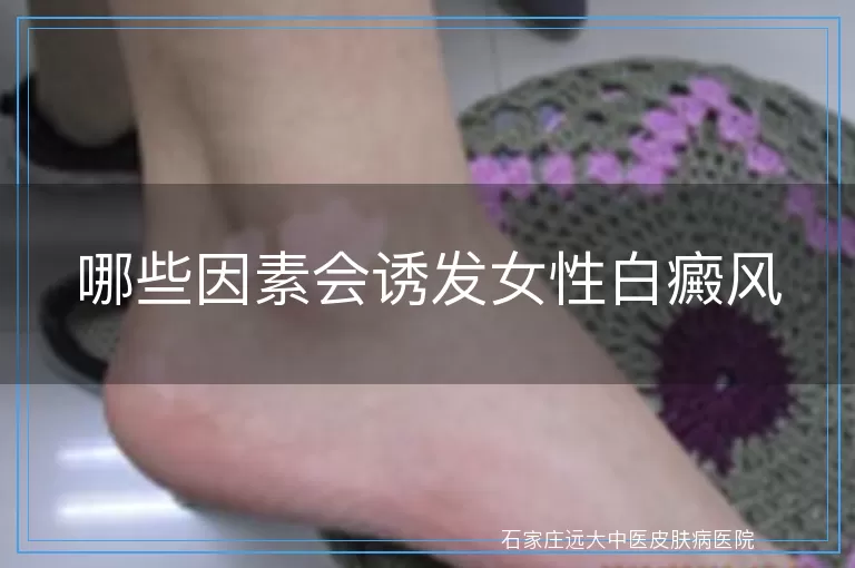 哪些因素会诱发女性白癜风