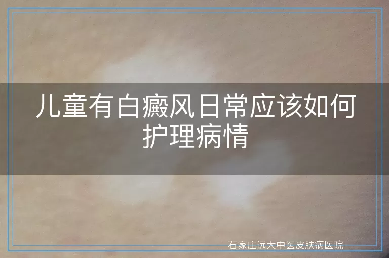 儿童有白癜风日常应该如何护理病情