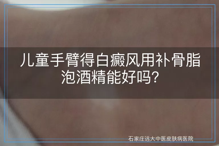 儿童手臂得白癜风用补骨脂泡酒精能好吗？