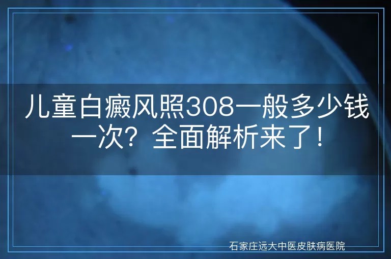 儿童白癜风照308一般多少钱一次？全面解析来了！