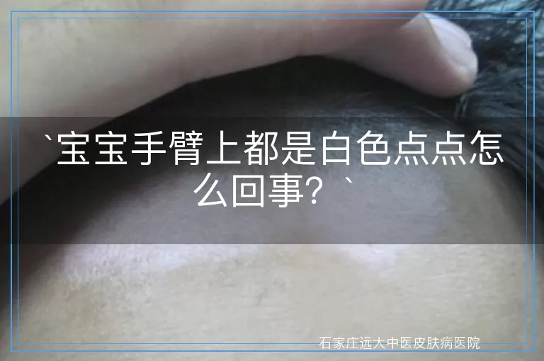 宝宝手臂上都是白色点点怎么回事？