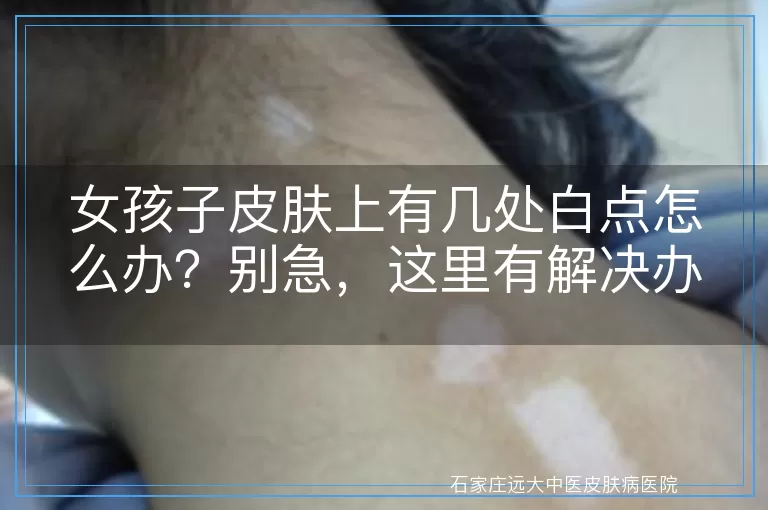 女孩子皮肤上有几处白点怎么办？别急，这里有解决办法！