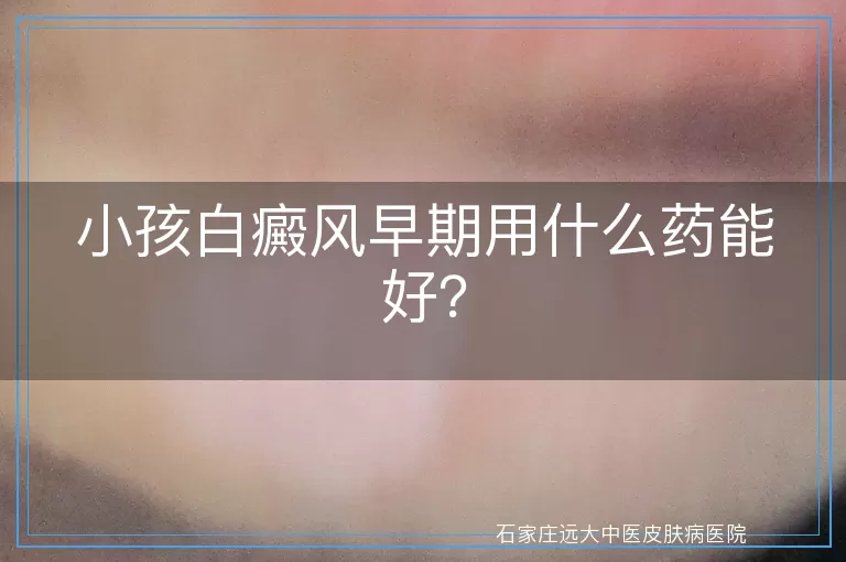 小孩白癜风早期用什么药能好？