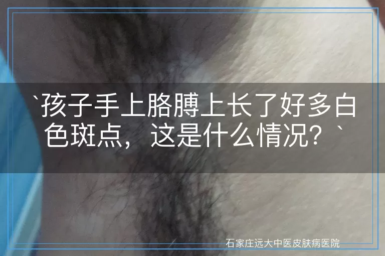 孩子手上胳膊上长了好多白色斑点，这是什么情况？