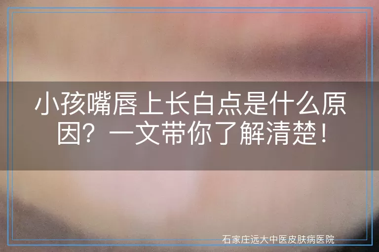 小孩嘴唇上长白点是什么原因？一文带你了解清楚！