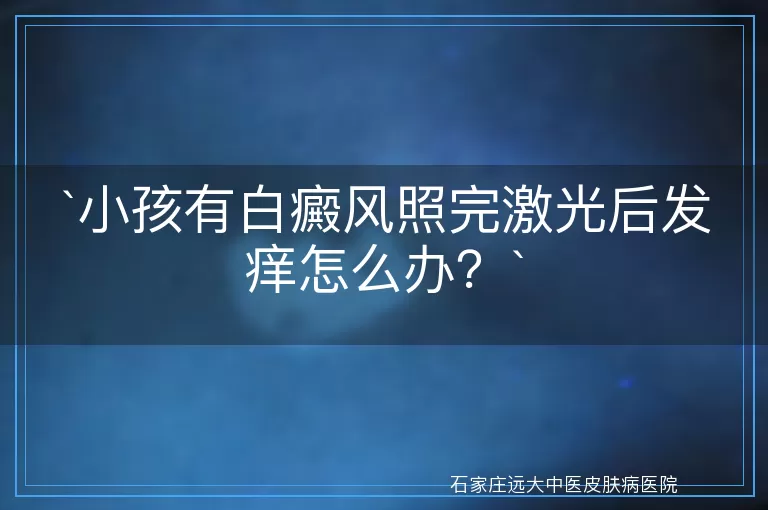 小孩有白癜风照完激光后发痒怎么办？
