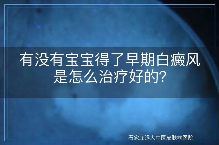 有没有宝宝得了早期白癜风是怎么治疗好的？