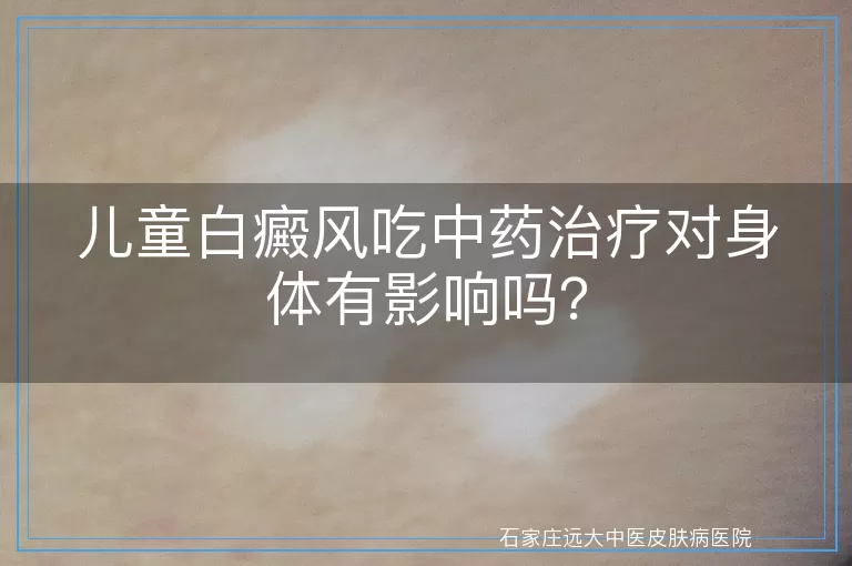 儿童白癜风吃中药治疗对身体有影响吗？