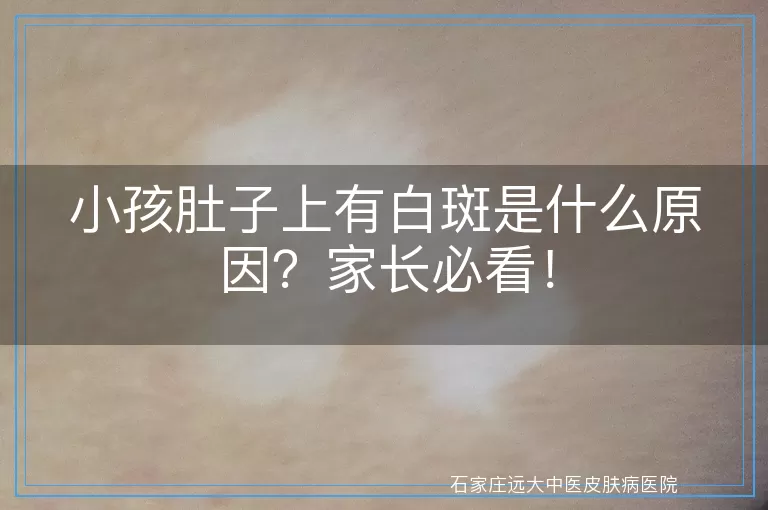 小孩肚子上有白斑是什么原因？家长必看！