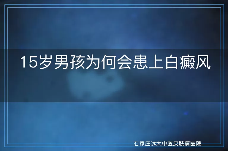 15岁男孩为何会患上白癜风
