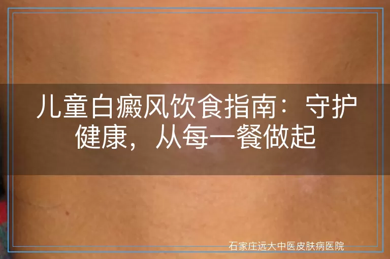 儿童白癜风饮食指南：守护健康，从每一餐做起