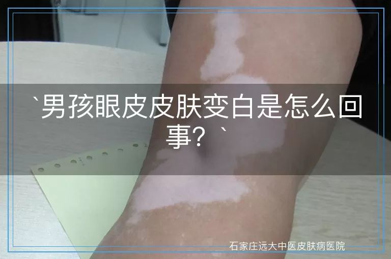 男孩眼皮皮肤变白是怎么回事？