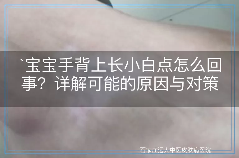 宝宝手背上长小白点怎么回事？详解可能的原因与对策