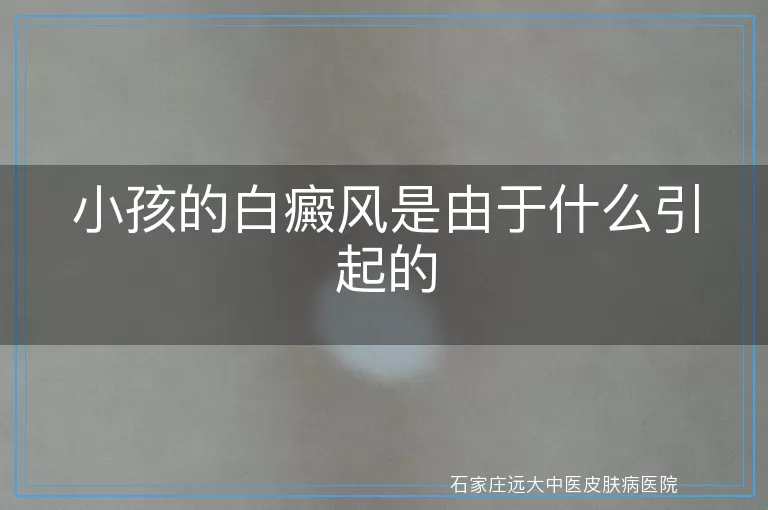 小孩的白癜风是由于什么引起的