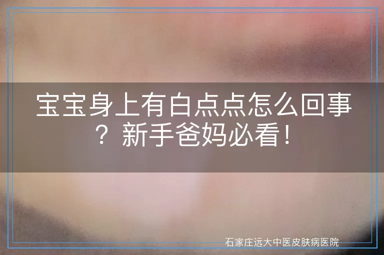 宝宝身上有白点点怎么回事？新手爸妈必看！