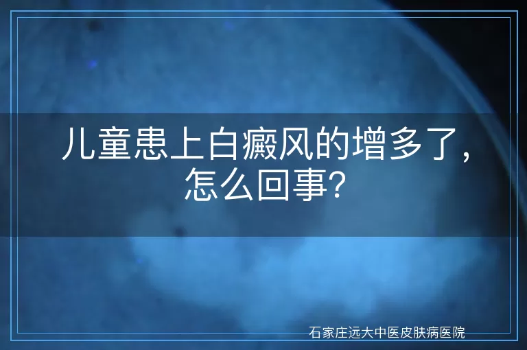 儿童患上白癜风的增多了，怎么回事？