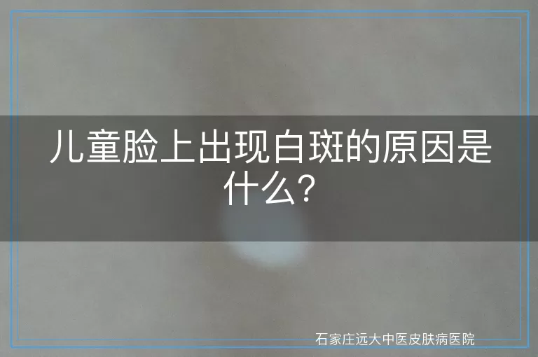 儿童脸上出现白斑的原因是什么？