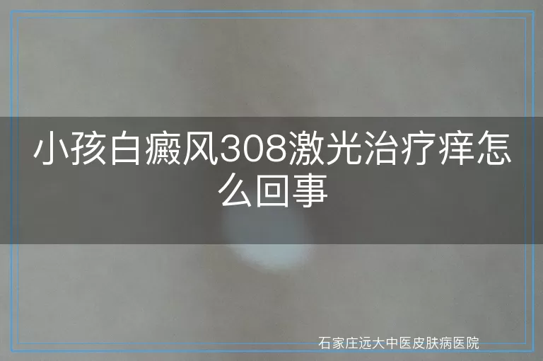 小孩白癜风308激光治疗痒怎么回事
