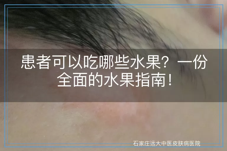 患者可以吃哪些水果？一份全面的水果指南！