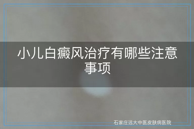 小儿白癜风治疗有哪些注意事项