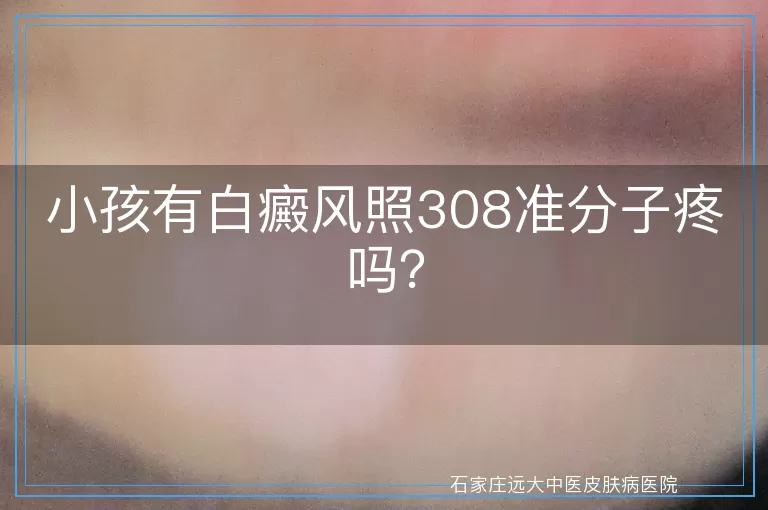 小孩有白癜风照308准分子疼吗？