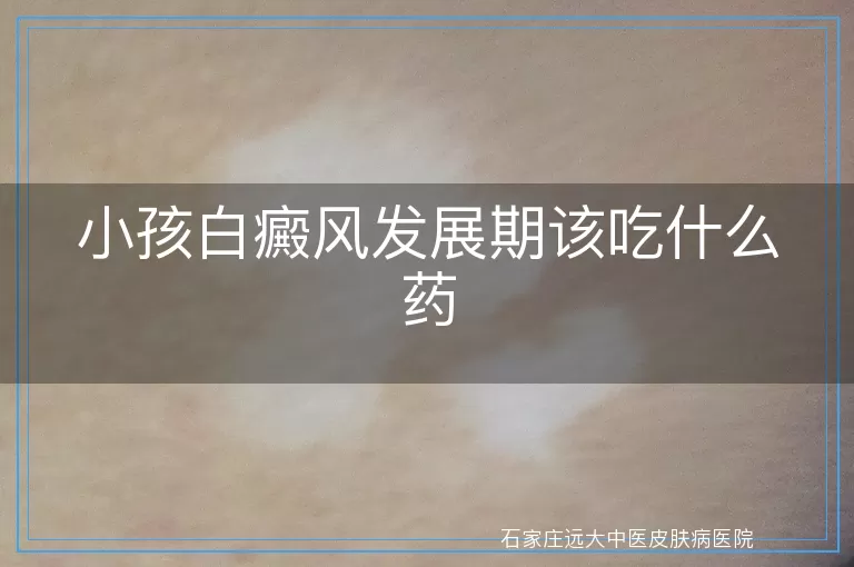 小孩白癜风发展期该吃什么药