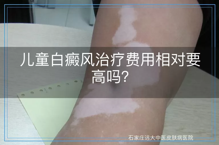 儿童白癜风治疗费用相对要高吗？
