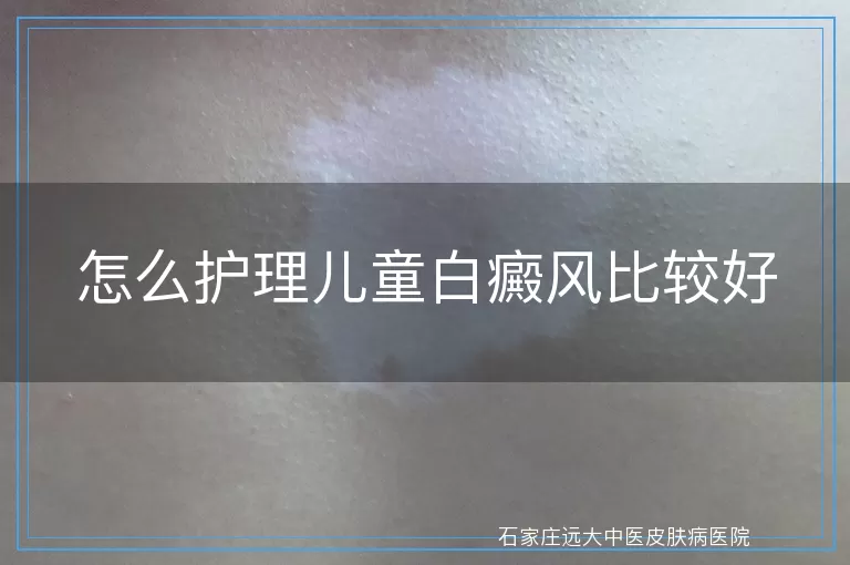 怎么护理儿童白癜风比较好