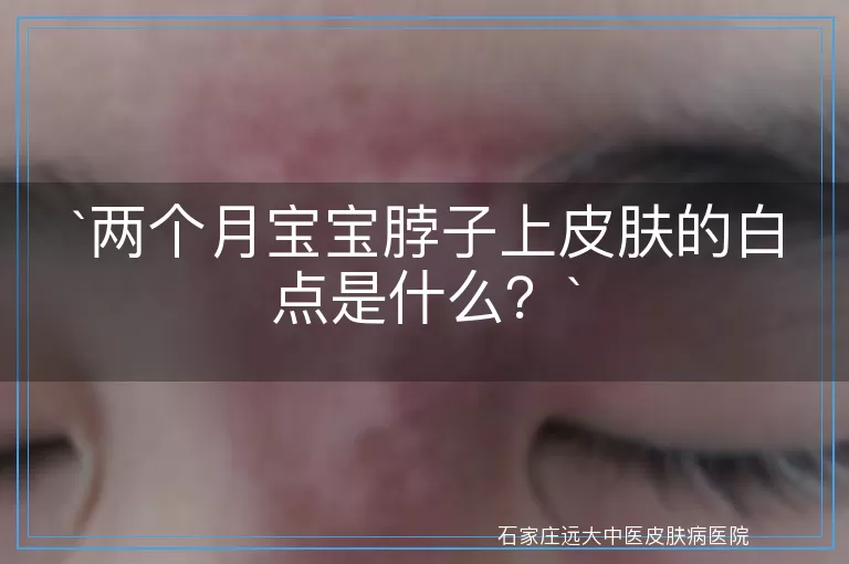 两个月宝宝脖子上皮肤的白点是什么?