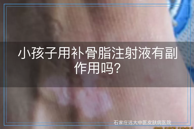 小孩子用补骨脂注射液有副作用吗？