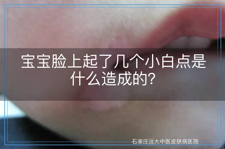 宝宝脸上起了几个小白点是什么造成的？