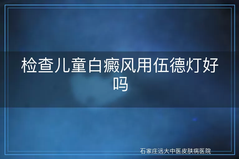 检查儿童白癜风用伍德灯好吗