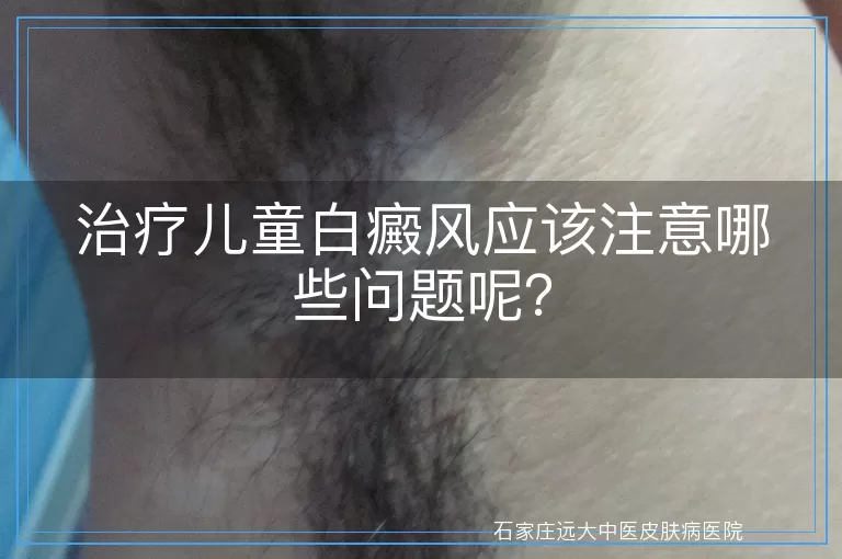 治疗儿童白癜风应该注意哪些问题呢？
