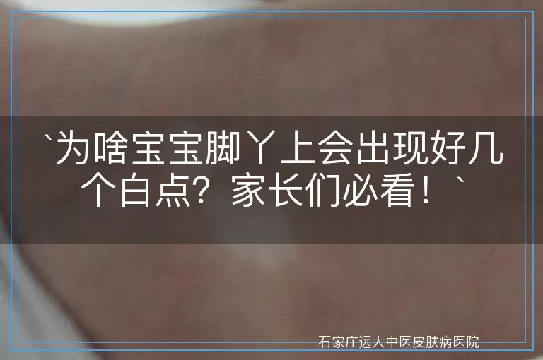 为啥宝宝脚丫上会出现好几个白点？家长们必看！