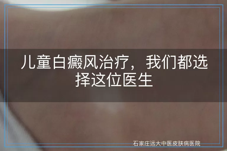 儿童白癜风治疗，我们都选择这位医生