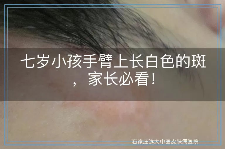 七岁小孩手臂上长白色的斑，家长必看！