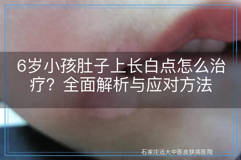 6岁小孩肚子上长白点怎么治疗？全面解析与应对方法