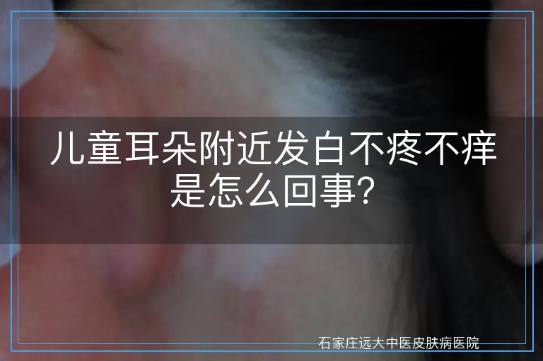 儿童耳朵附近发白不疼不痒是怎么回事？