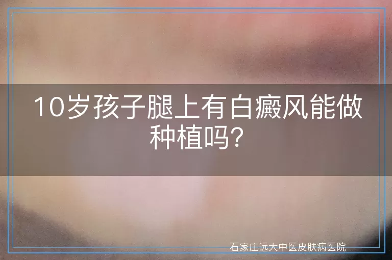 10岁孩子腿上有白癜风能做种植吗？