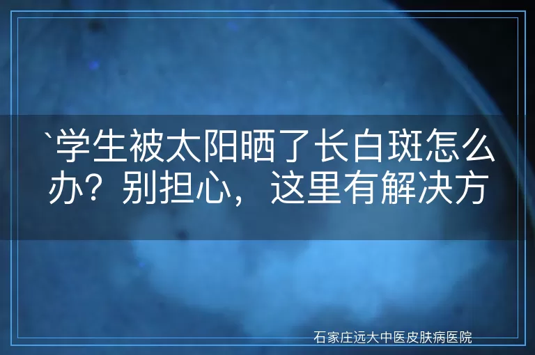 学生被太阳晒了长白斑怎么办？别担心，这里有解决方案！