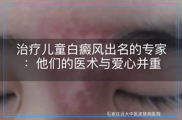 治疗儿童白癜风出名的专家：他们的医术与爱心并重