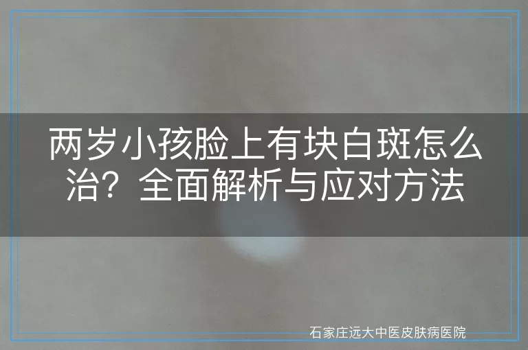 两岁小孩脸上有块白斑怎么治？全面解析与应对方法