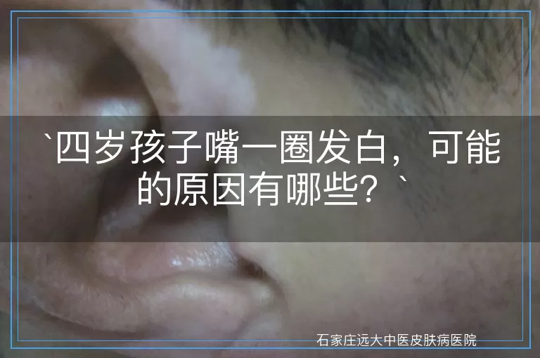 四岁孩子嘴一圈发白，可能的原因有哪些？